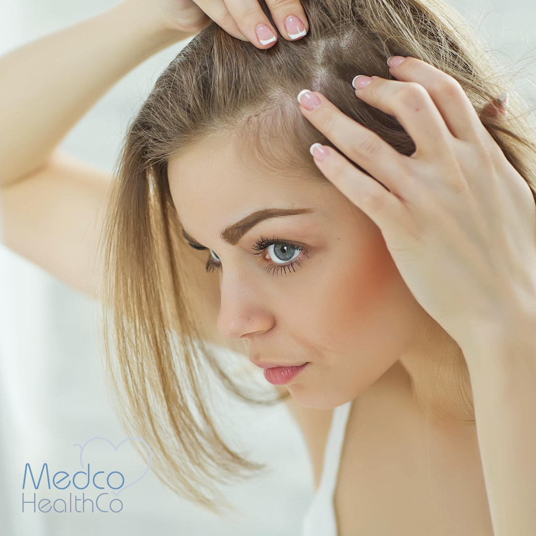 FUE Technique Hair Transplant for Women | Medco Healthco | Stay Safe and  Healthy