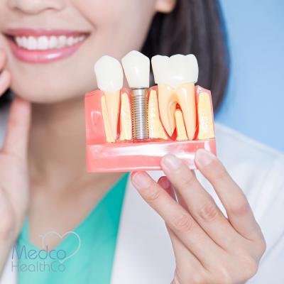 Dental Implants