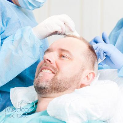 Hair Transplant Guideline